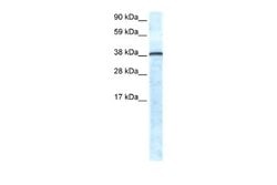 GFI-1 Rabbit anti-Human, Polyclonal, Novus Biologicals 0.1 mL | Buy Online | Novus Biologicals | Fisher Scientific
